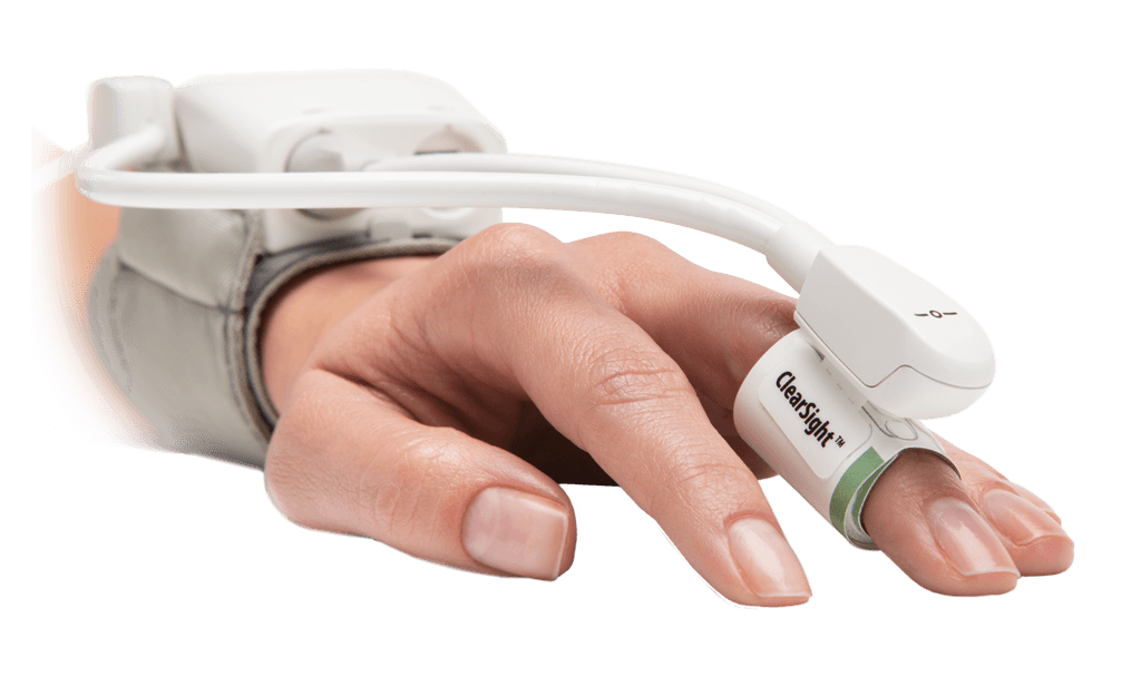 Acumen Assisted Fluid Management